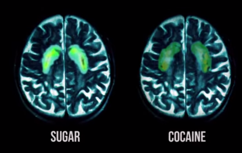 Cocaine & Sugar
